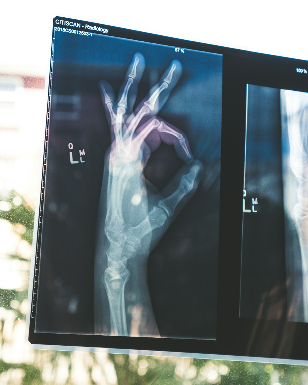 Medical imaging technology